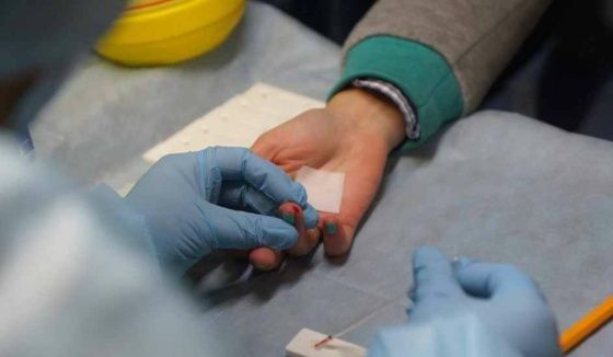 В Екатеринбурге проведут бесплатное экспресс-тестирование на ВИЧ